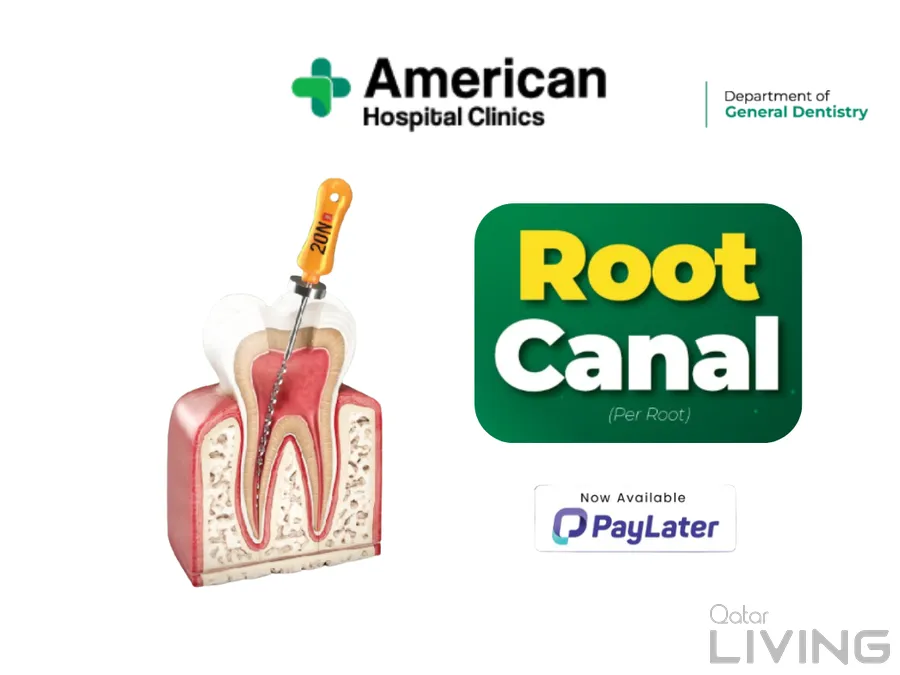 Root Canal Treatment - 499 QAR